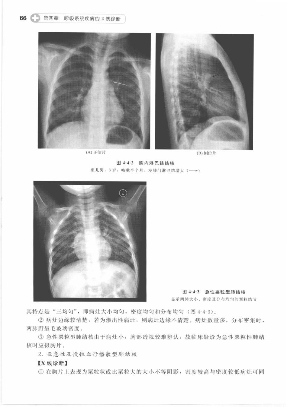 X线读片指南_13282062_76-90.pdf_第2页