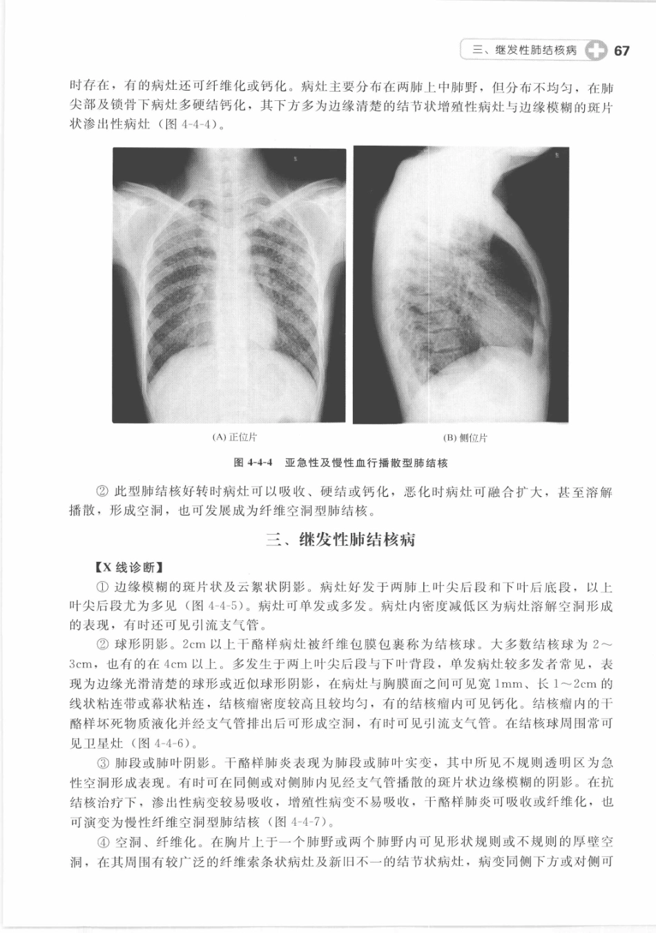 X线读片指南_13282062_76-90.pdf_第3页