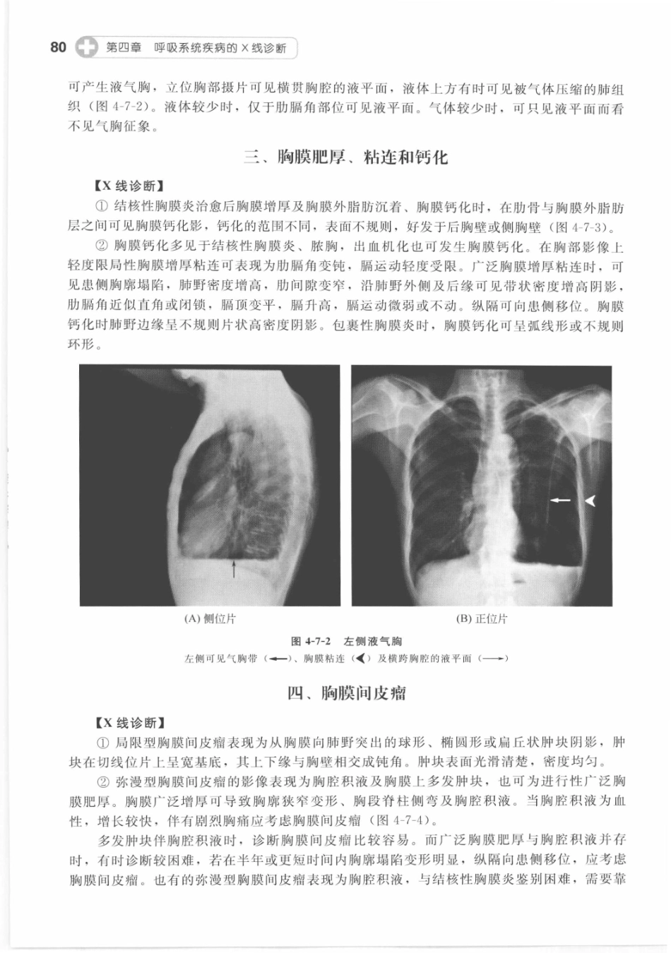 X线读片指南_13282062_91-105.pdf_第1页