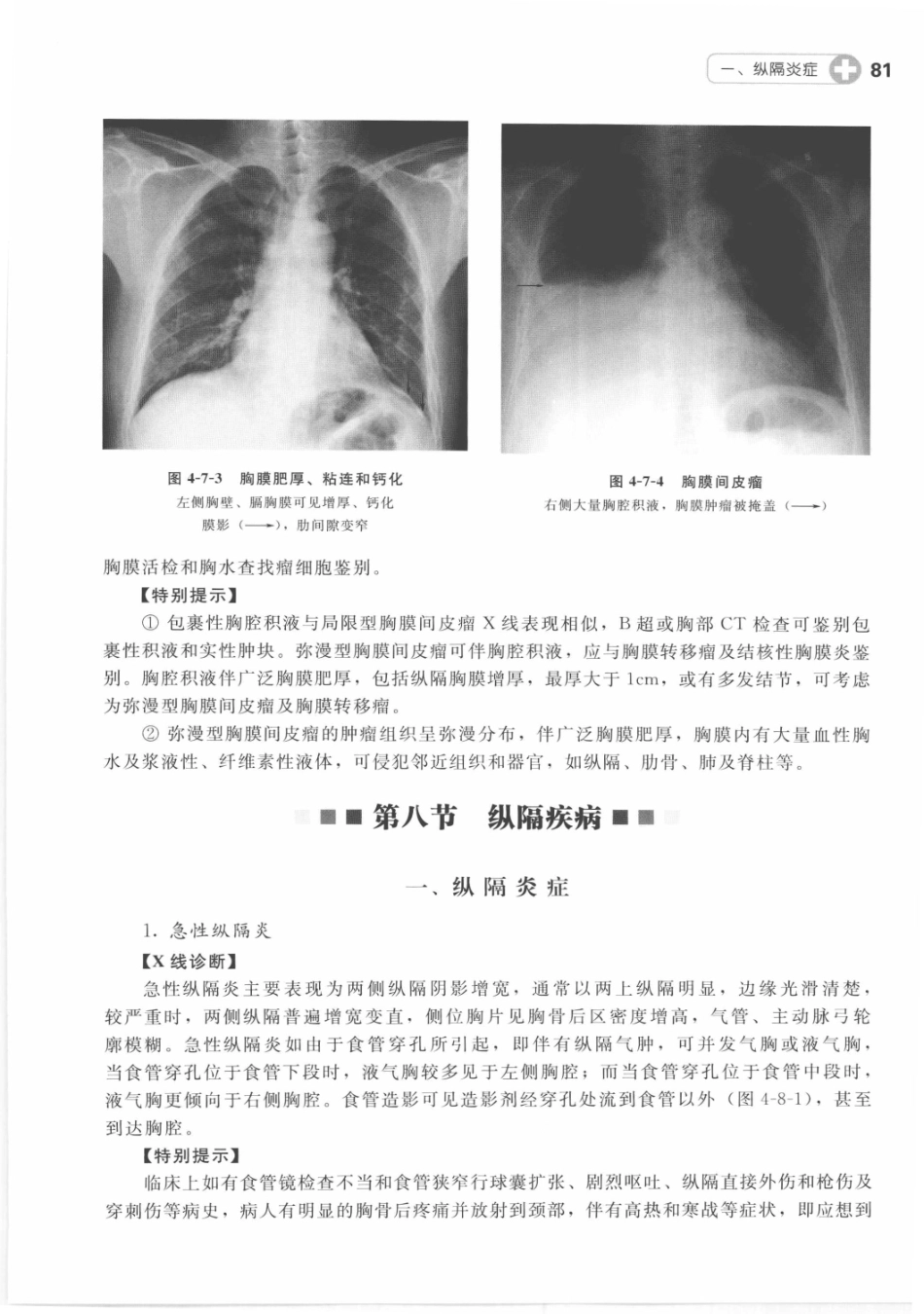 X线读片指南_13282062_91-105.pdf_第2页