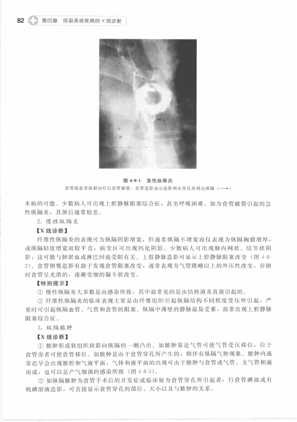 X线读片指南_13282062_91-105.pdf_第3页