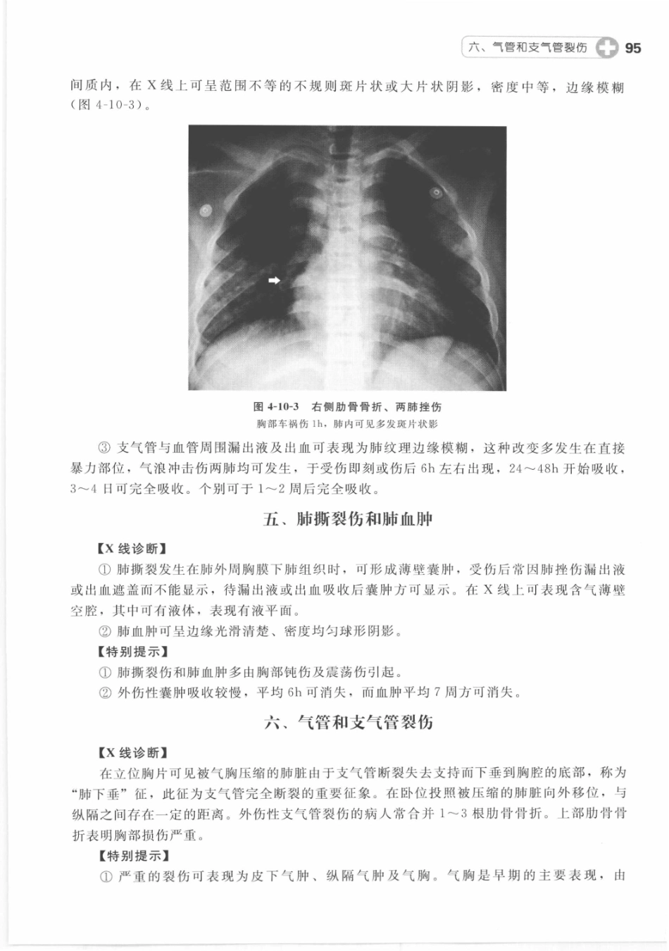 X线读片指南_13282062_106-120.pdf_第1页