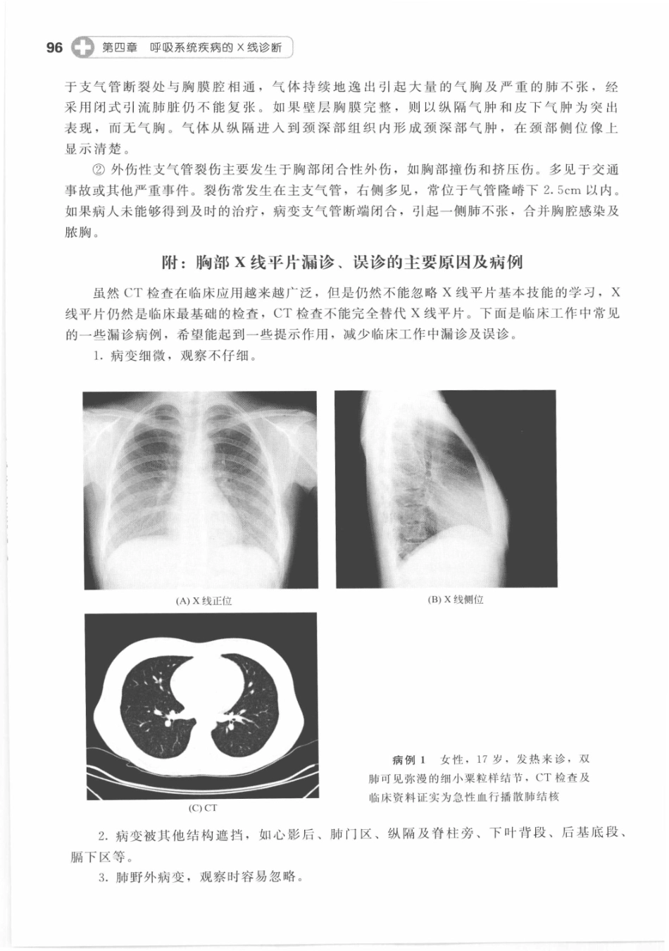 X线读片指南_13282062_106-120.pdf_第2页