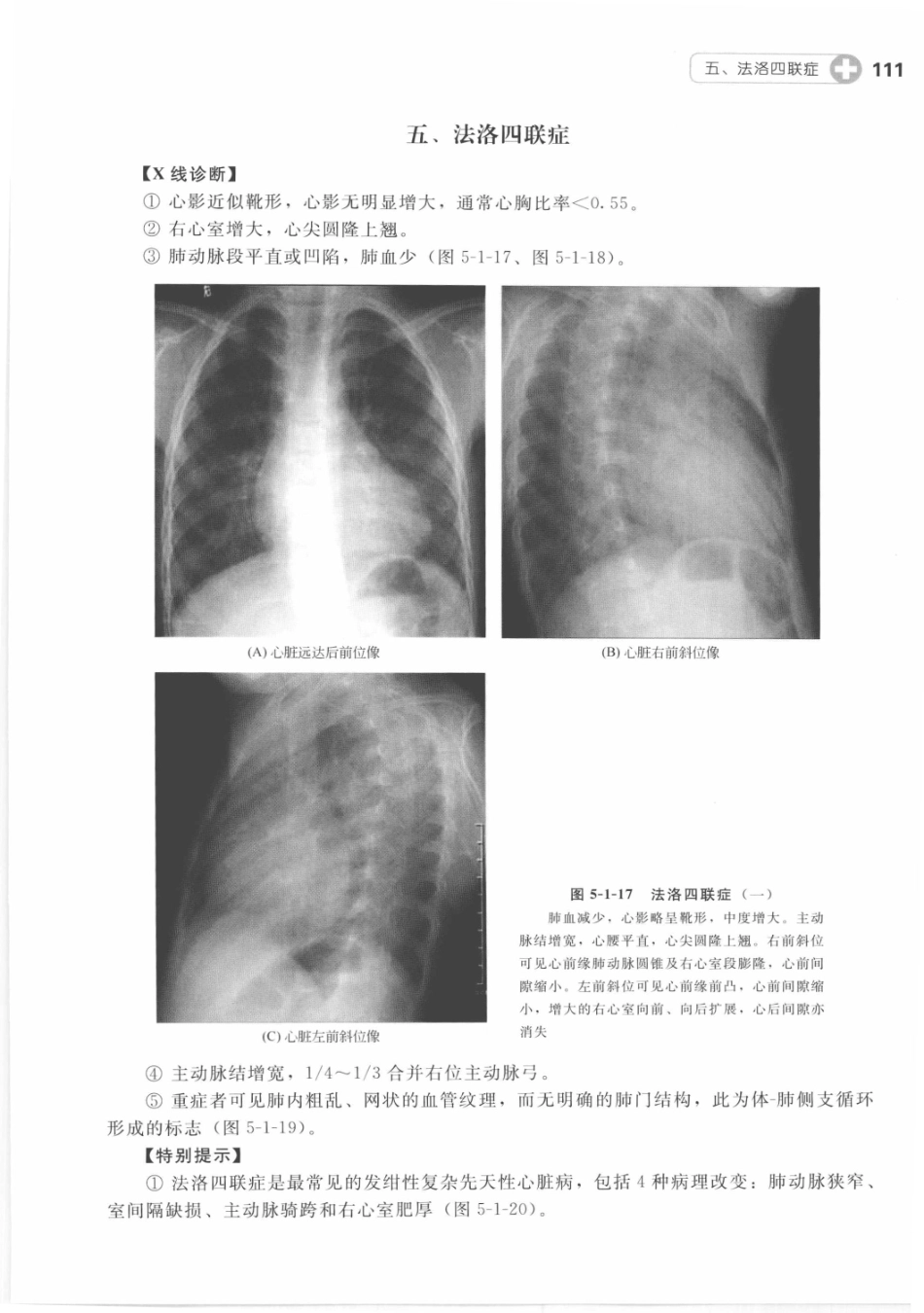 X线读片指南_13282062_121-135.pdf_第2页