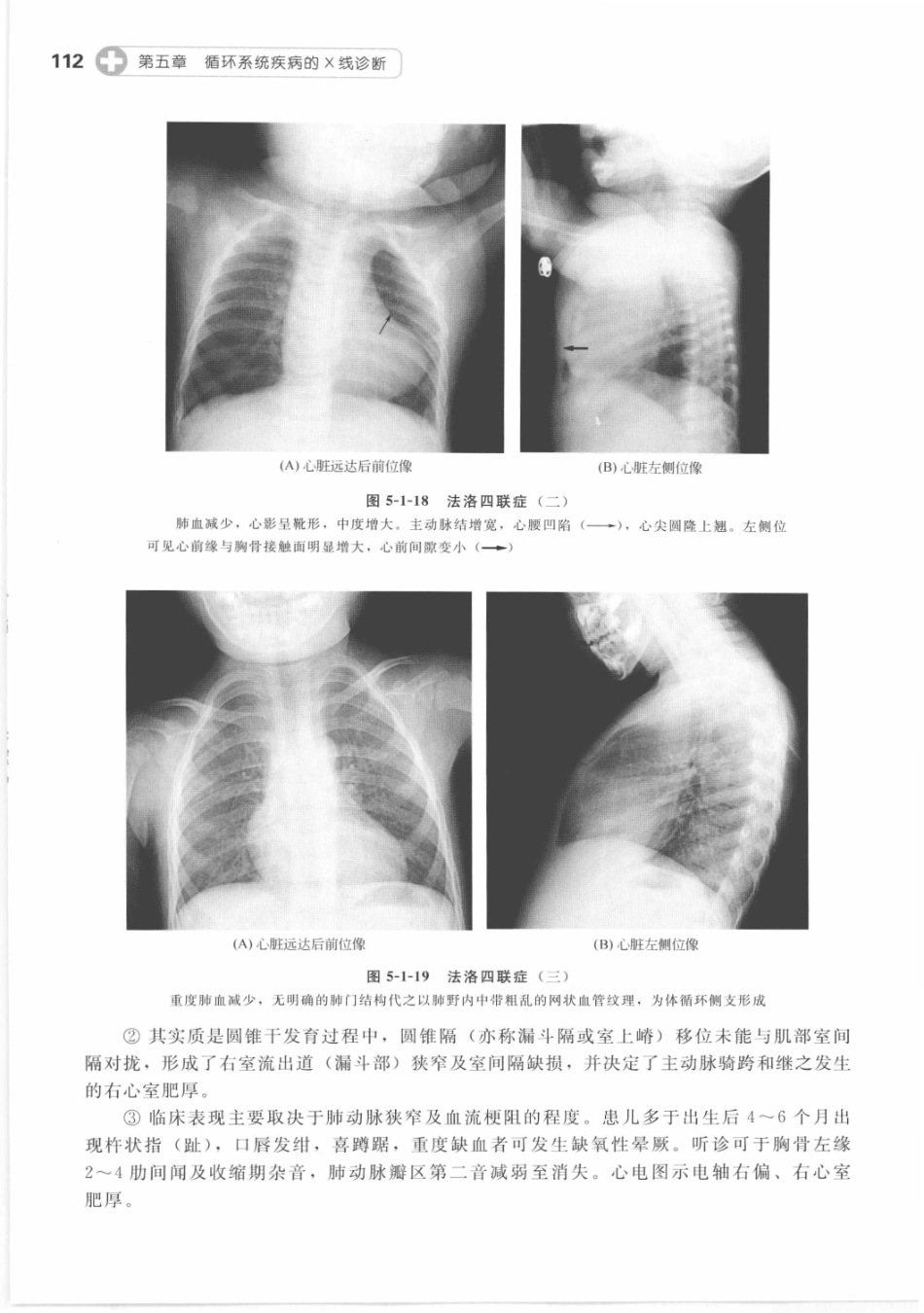 X线读片指南_13282062_121-135.pdf_第3页