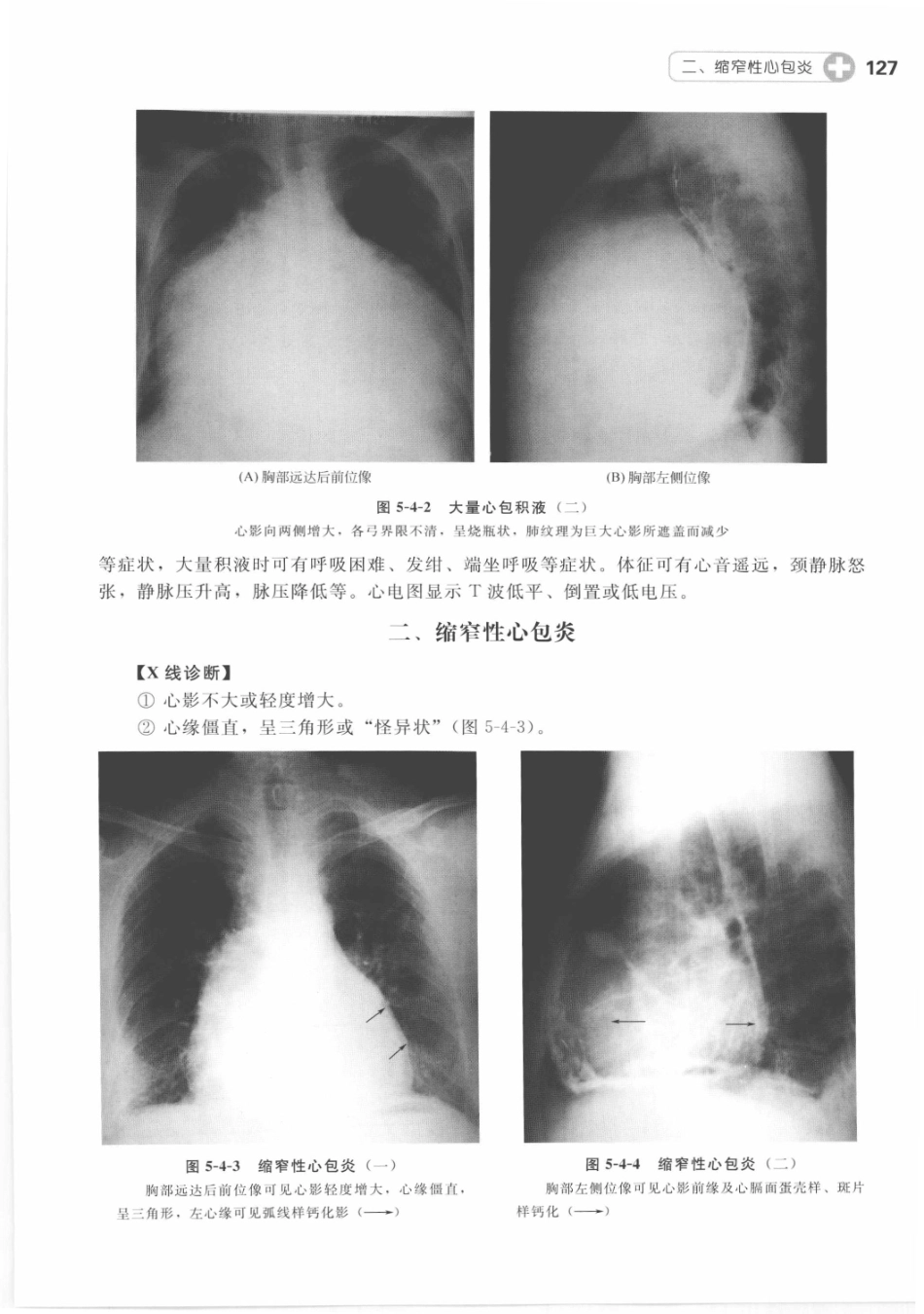 X线读片指南_13282062_136-150.pdf_第3页