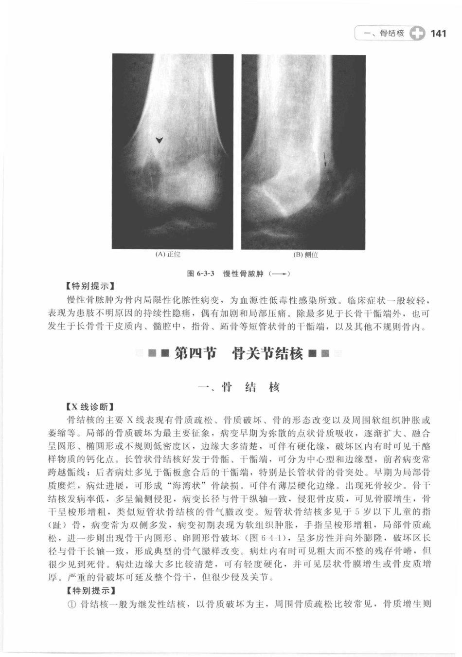 X线读片指南_13282062_151-165.pdf_第2页