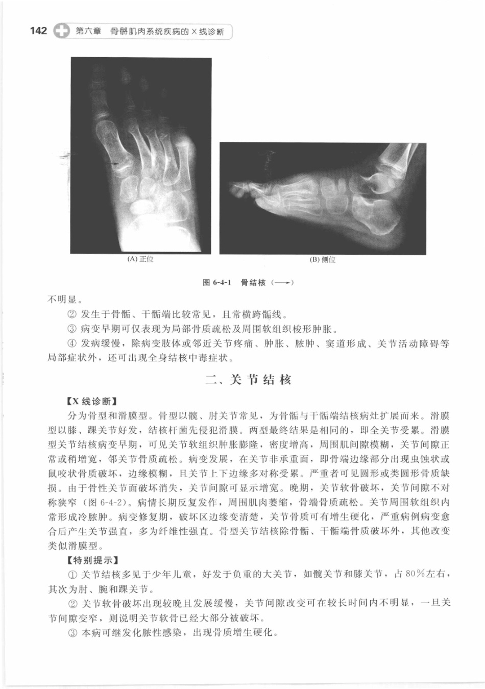 X线读片指南_13282062_151-165.pdf_第3页