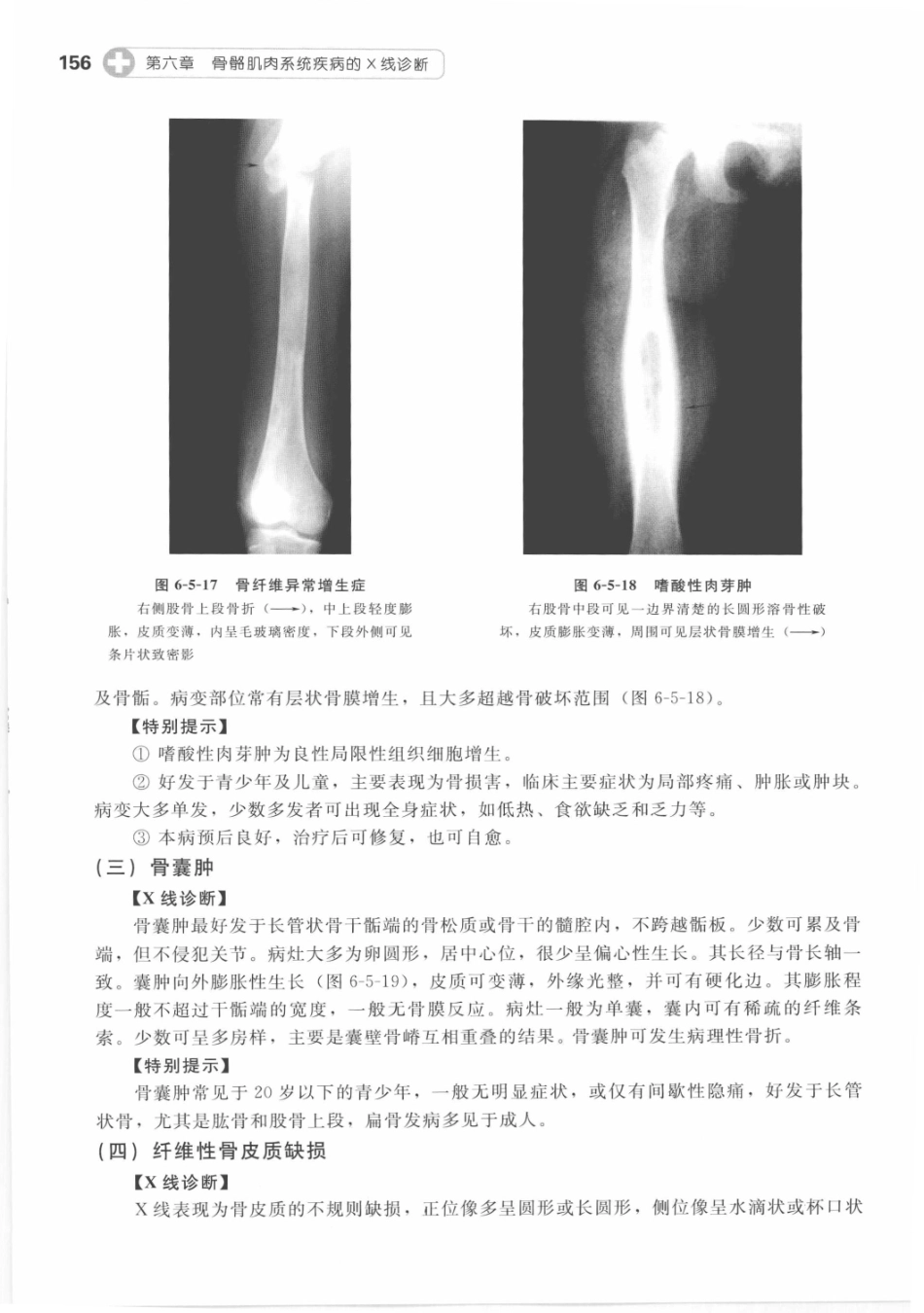 X线读片指南_13282062_166-180.pdf_第2页