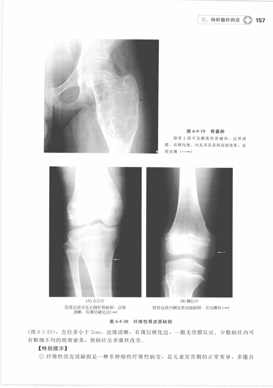 X线读片指南_13282062_166-180.pdf_第3页