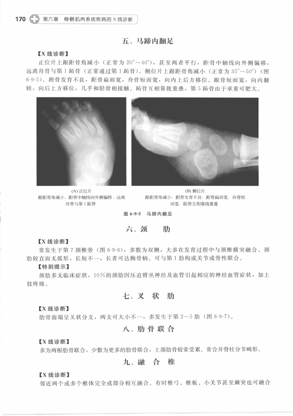 X线读片指南_13282062_181-195.pdf_第1页