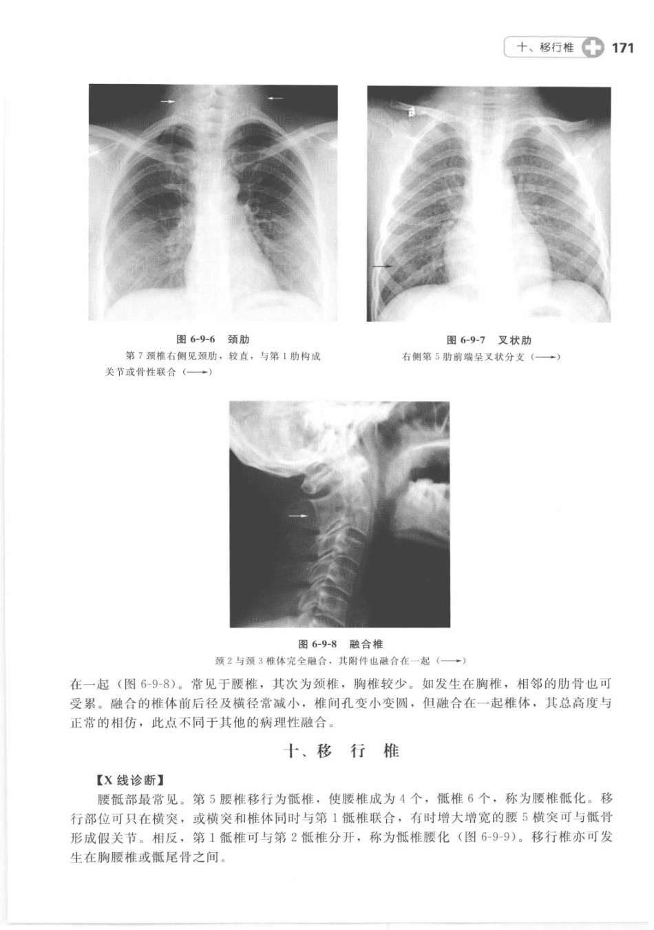 X线读片指南_13282062_181-195.pdf_第2页