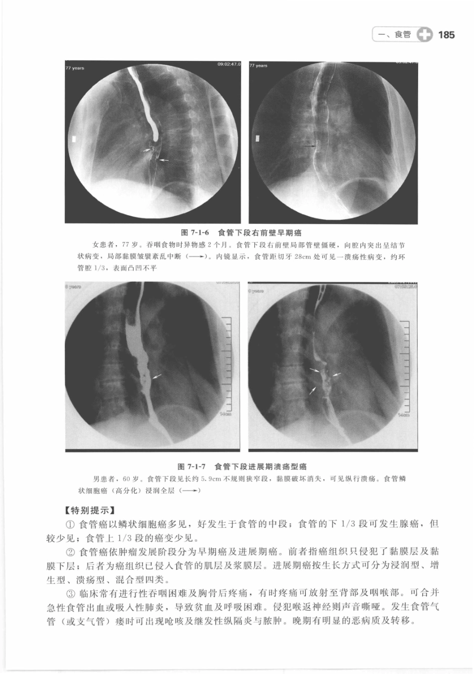 X线读片指南_13282062_196-210.pdf_第1页