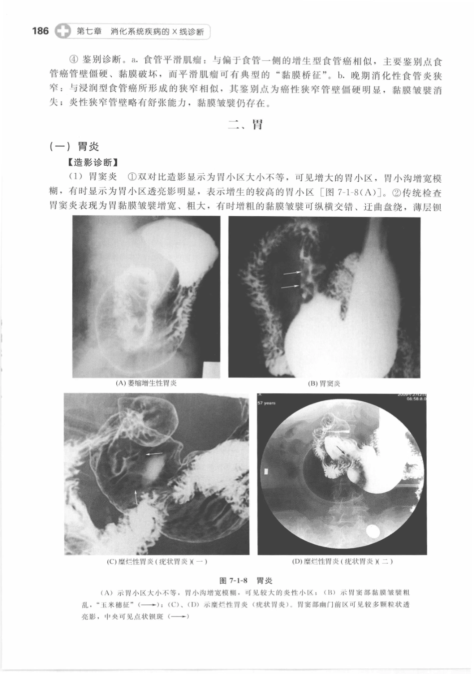 X线读片指南_13282062_196-210.pdf_第2页
