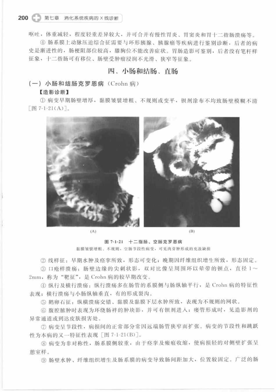 X线读片指南_13282062_211-225.pdf_第1页