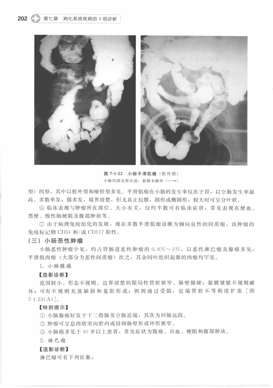 X线读片指南_13282062_211-225.pdf_第3页