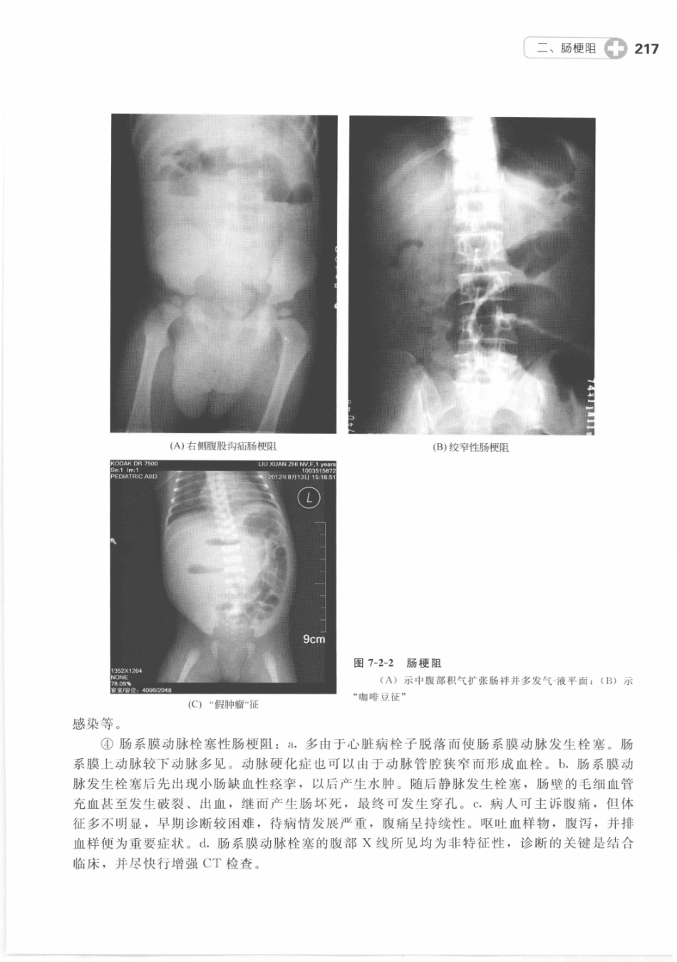 X线读片指南_13282062_226-240.pdf_第3页