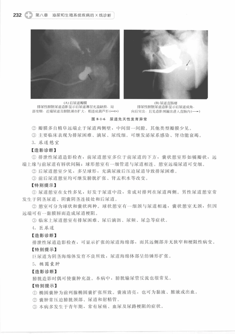 X线读片指南_13282062_241-255.pdf_第3页