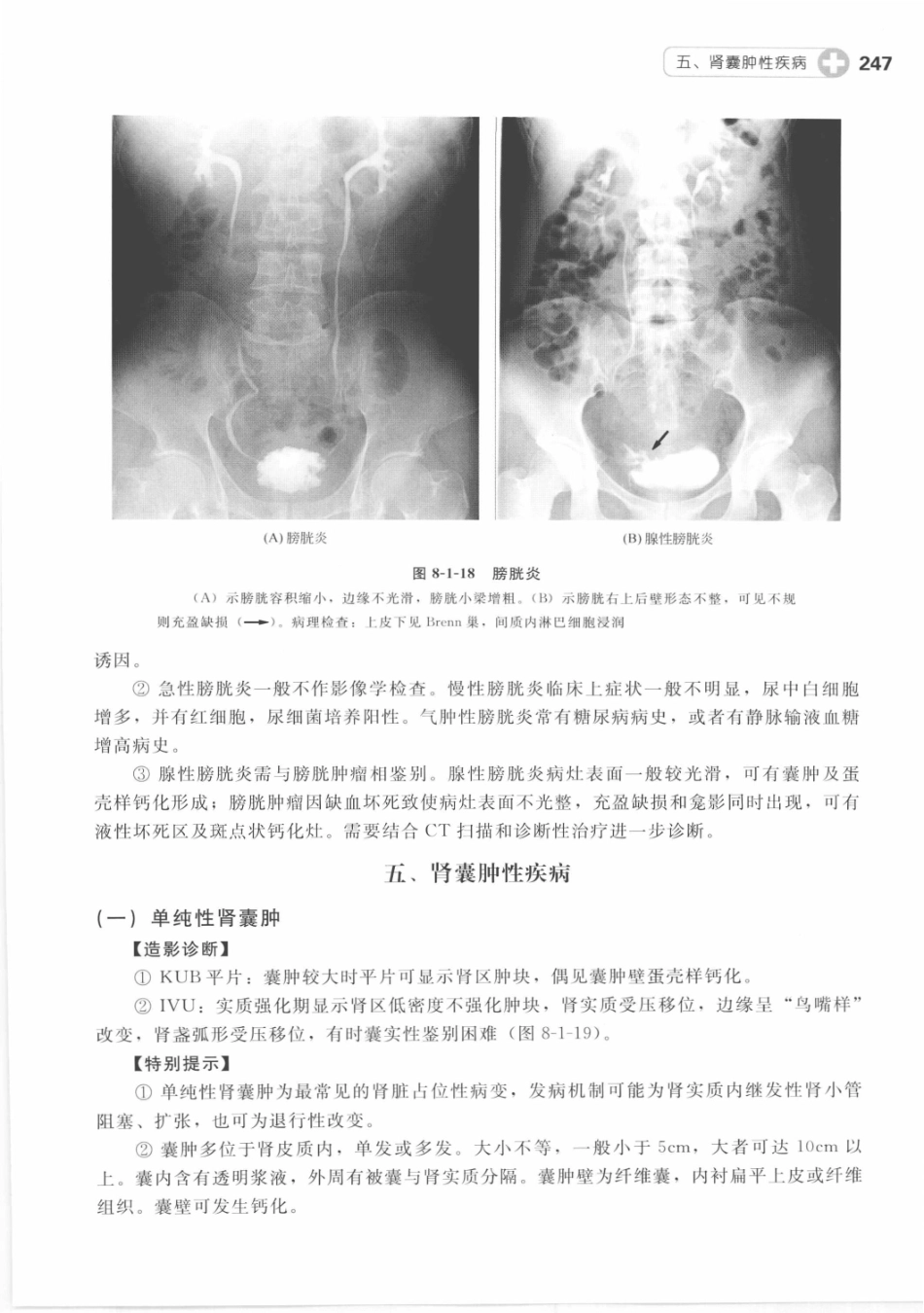 X线读片指南_13282062_256-270.pdf_第3页