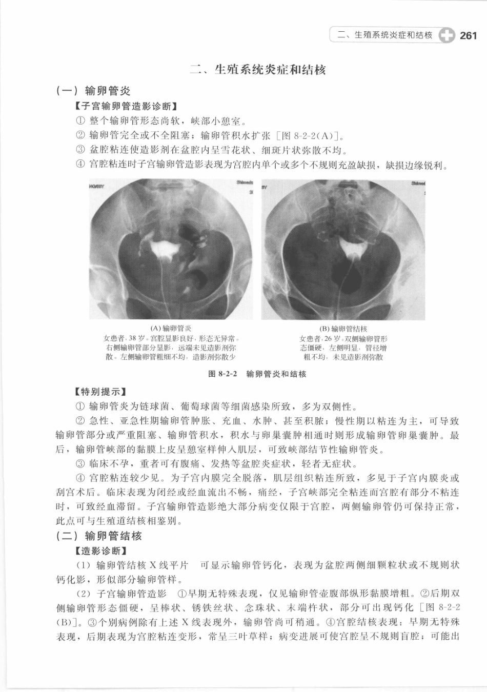 X线读片指南_13282062_271-285.pdf_第2页