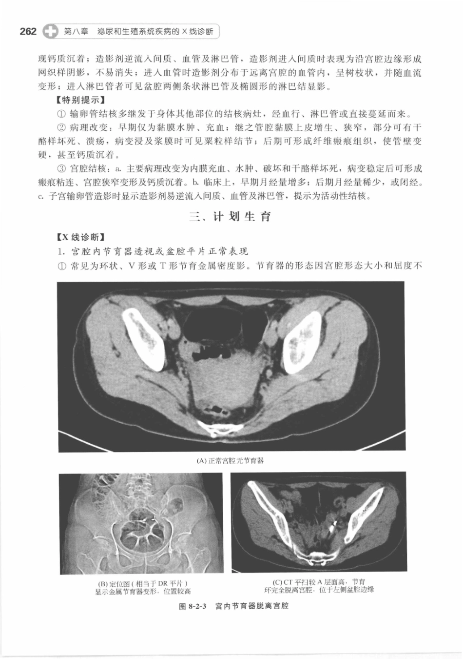 X线读片指南_13282062_271-285.pdf_第3页
