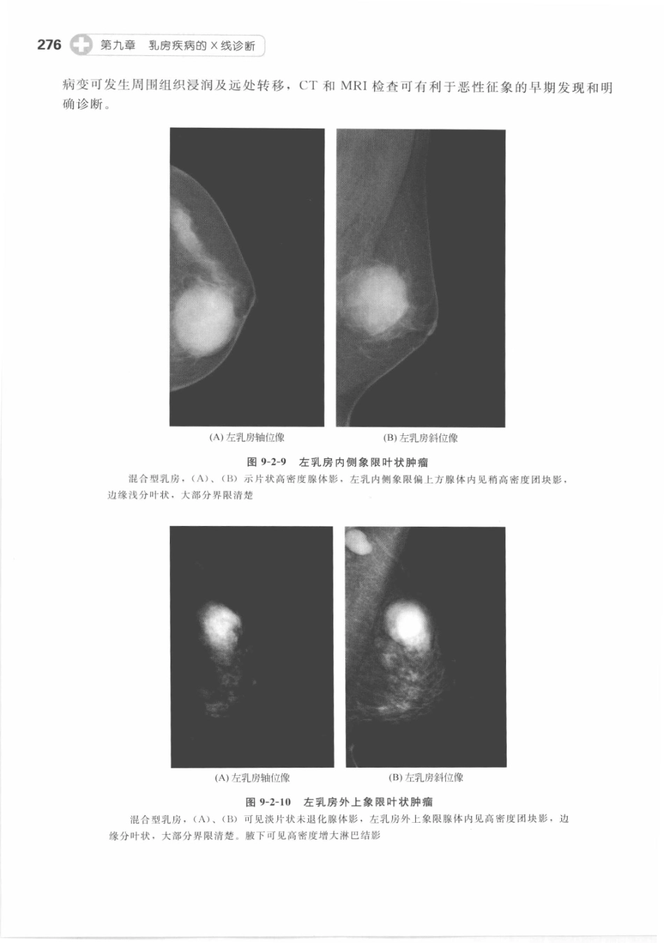X线读片指南_13282062_286-292.pdf_第2页