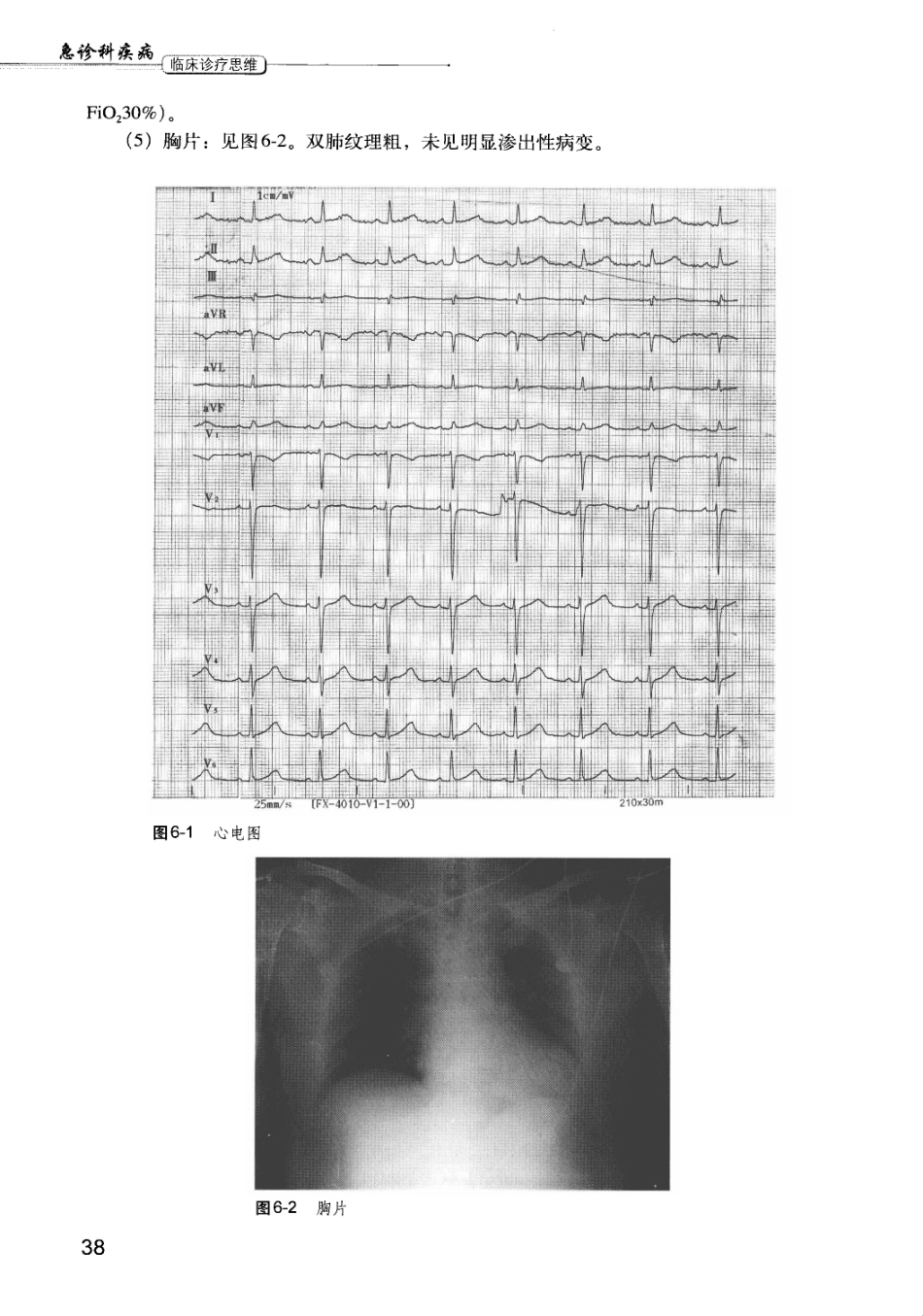 急诊科疾病临床诊疗思维_12385287_46-60.pdf_第1页