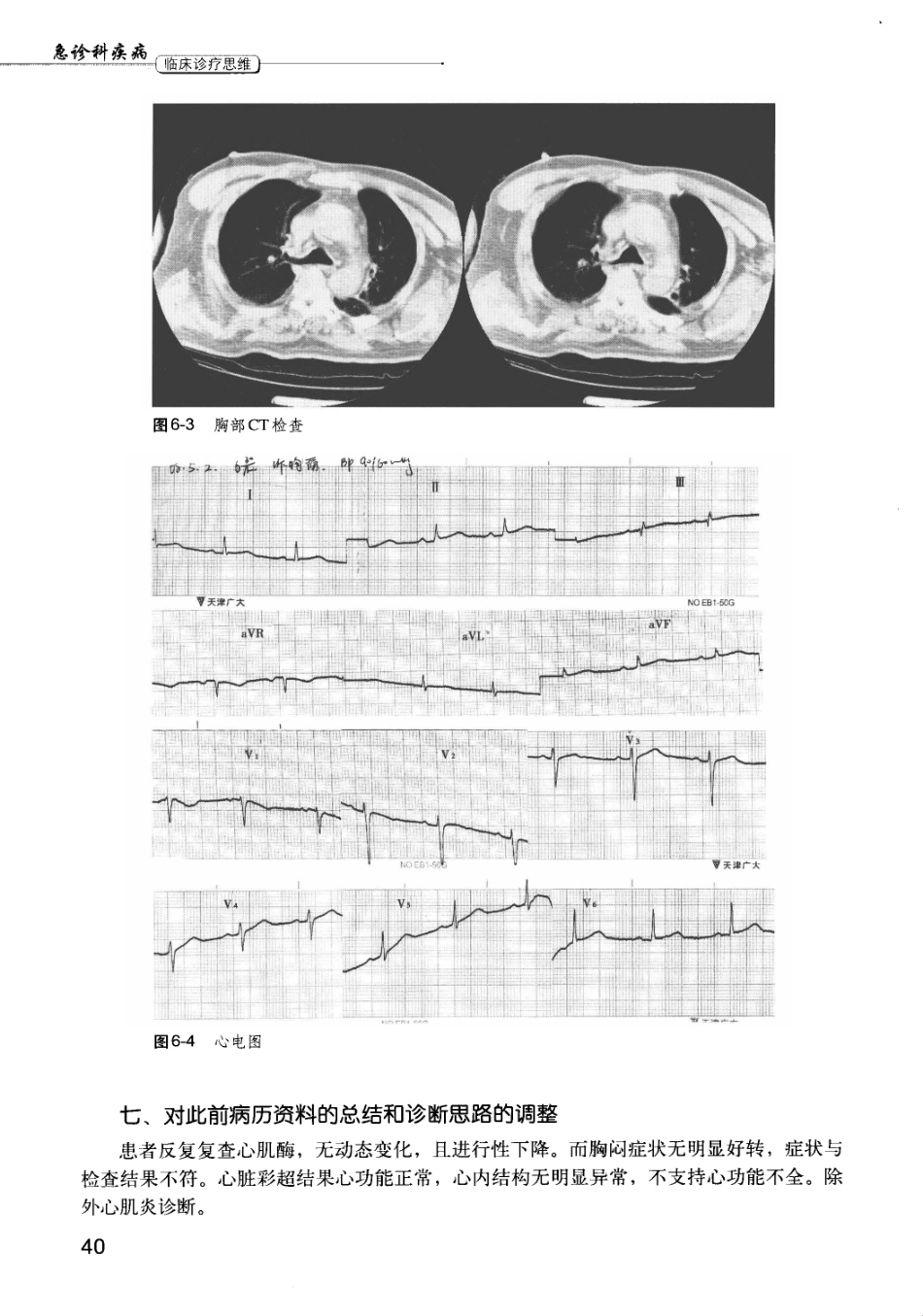 急诊科疾病临床诊疗思维_12385287_46-60.pdf_第3页