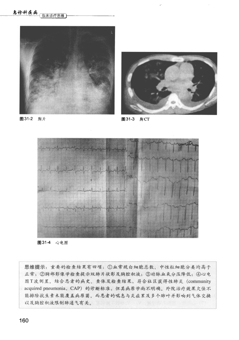 急诊科疾病临床诊疗思维_12385287_166-180.pdf_第3页