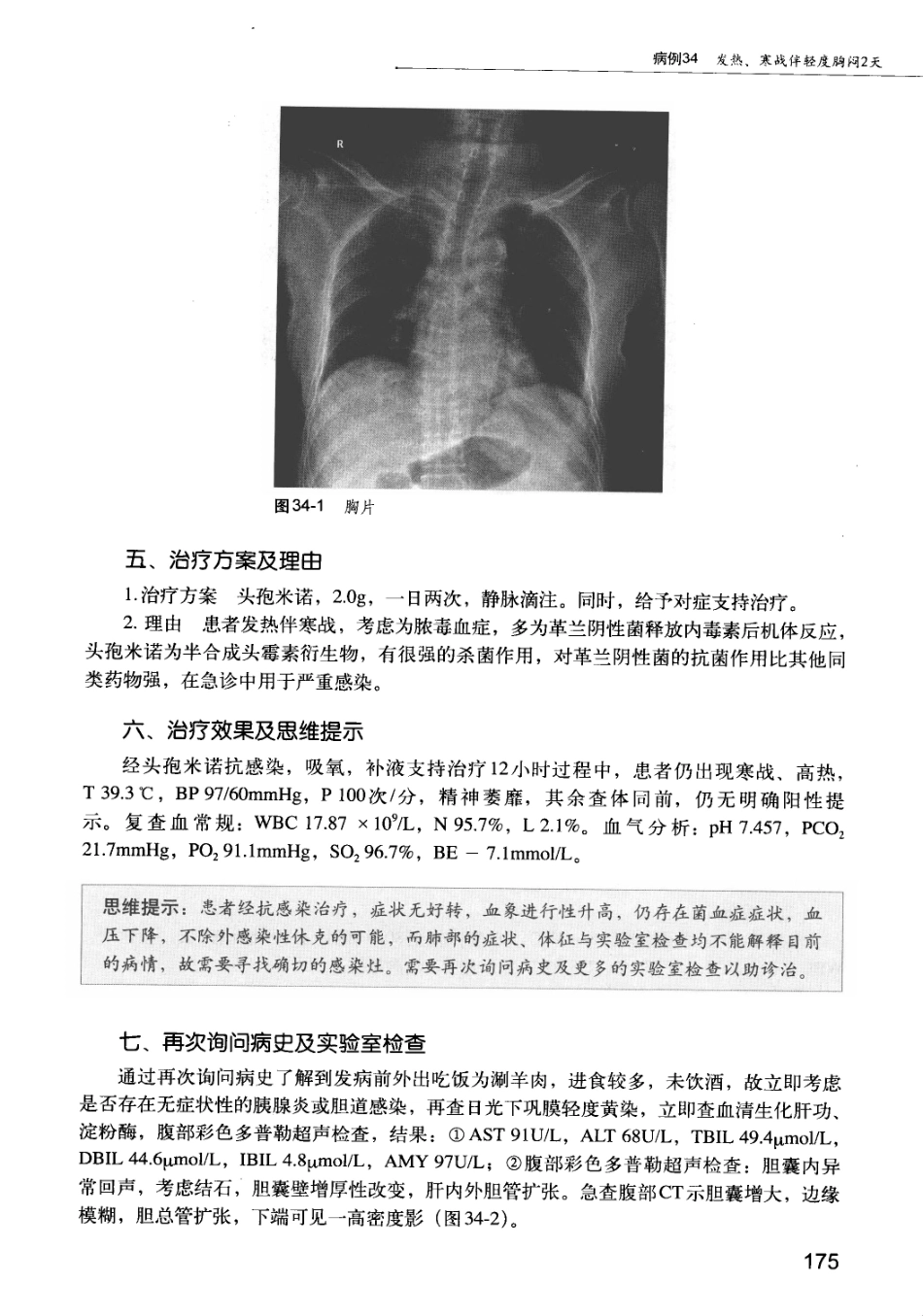 急诊科疾病临床诊疗思维_12385287_181-195.pdf_第3页