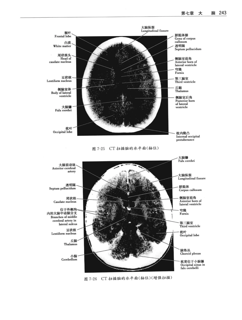 临床神经解剖++第7版_12997509_261-280.pdf_第2页