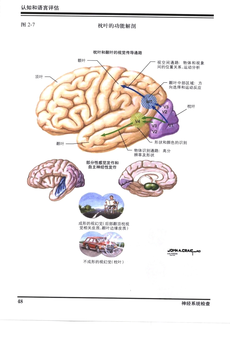 奈特神经系统疾病彩色图谱_樊东升2009译（全彩图）_61-90.pdf_第1页