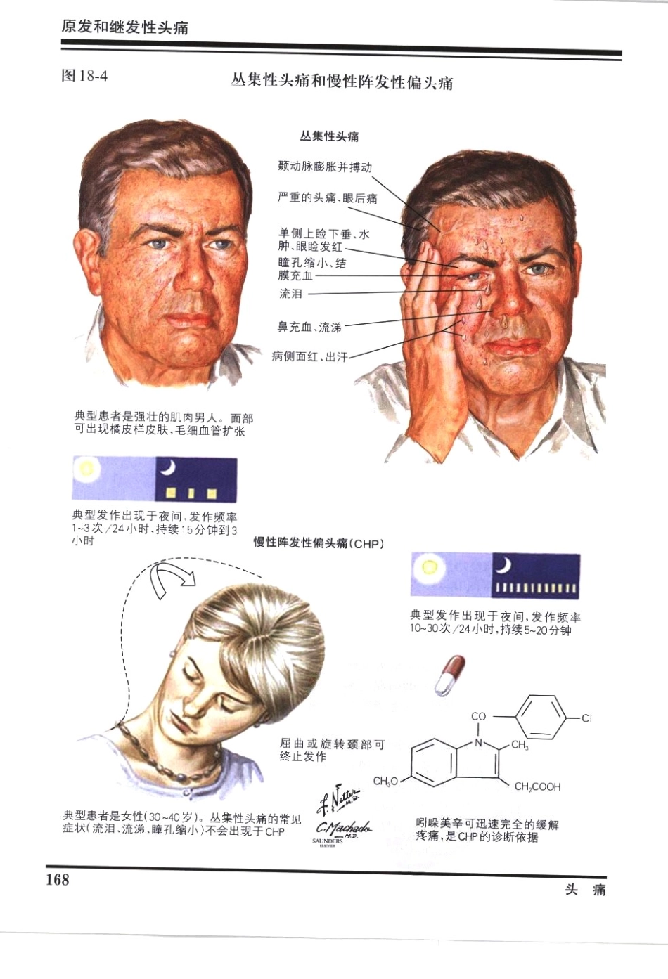 奈特神经系统疾病彩色图谱_樊东升2009译（全彩图）_181-210.pdf_第1页