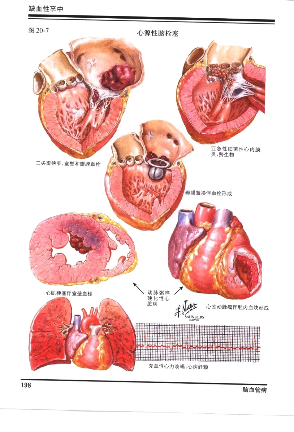 奈特神经系统疾病彩色图谱_樊东升2009译（全彩图）_211-240.pdf_第1页