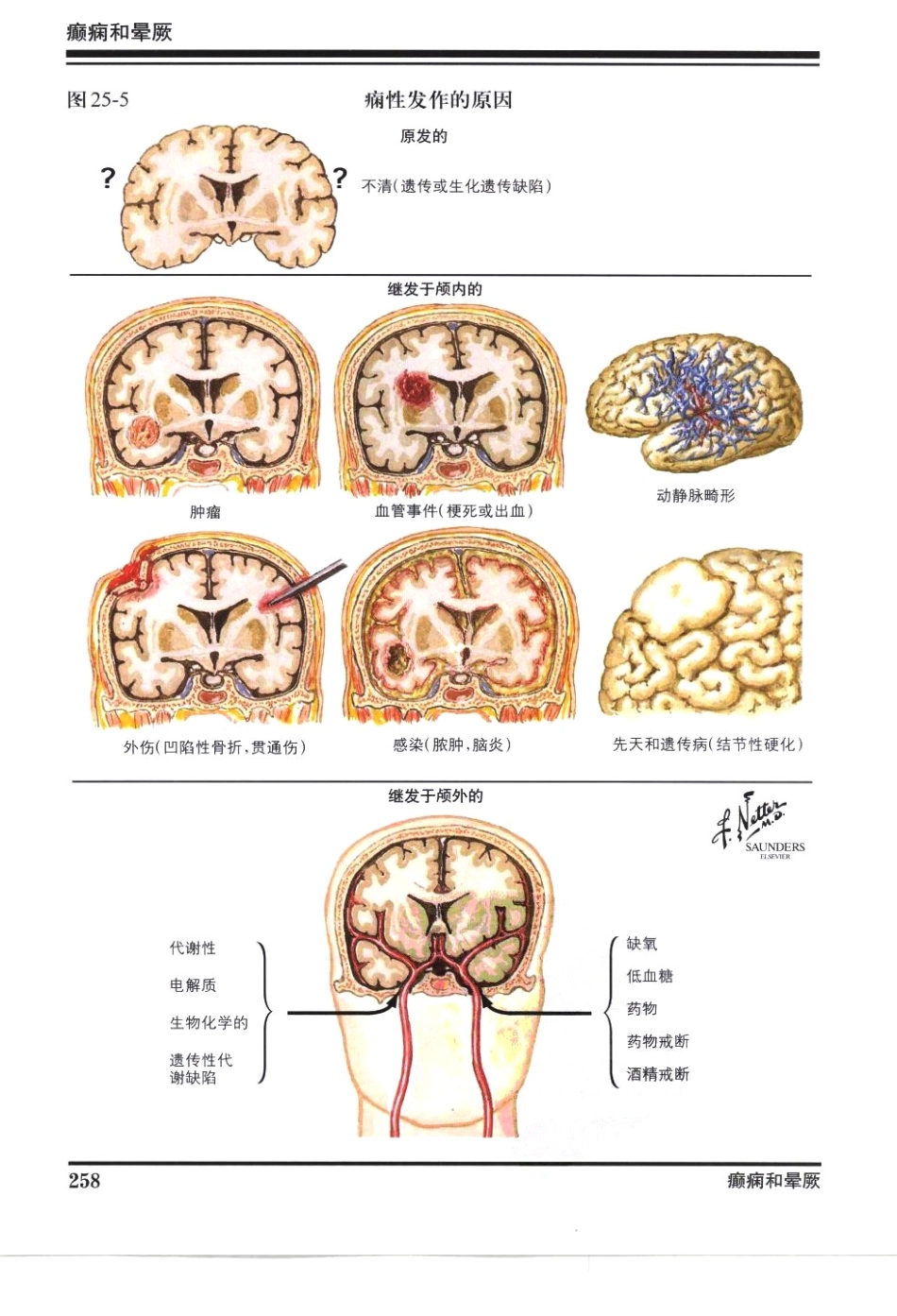 奈特神经系统疾病彩色图谱_樊东升2009译（全彩图）_271-300.pdf_第1页