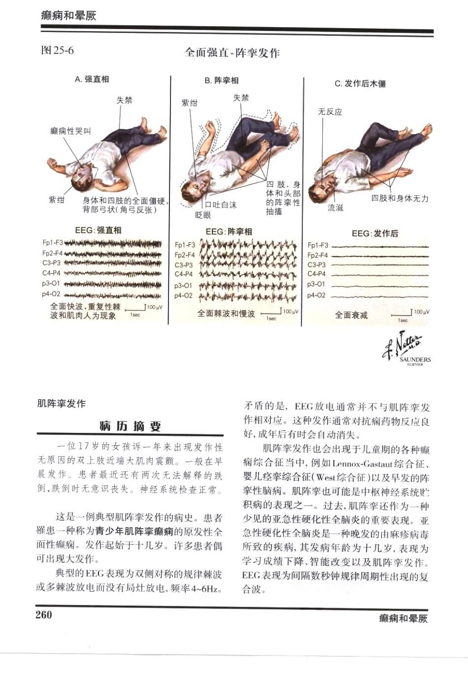 奈特神经系统疾病彩色图谱_樊东升2009译（全彩图）_271-300.pdf_第3页
