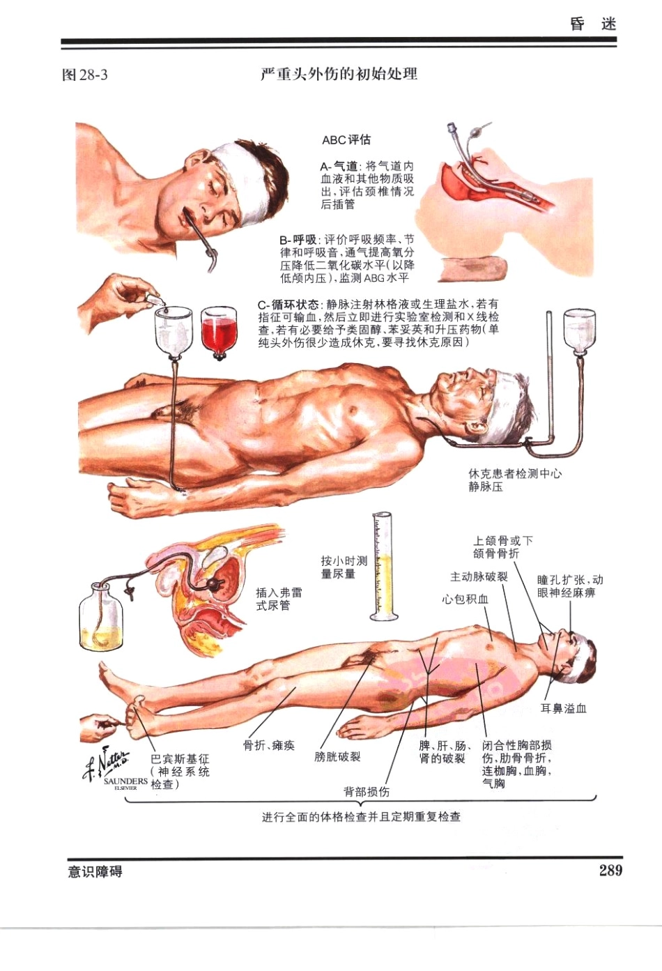 奈特神经系统疾病彩色图谱_樊东升2009译（全彩图）_301-330.pdf_第2页