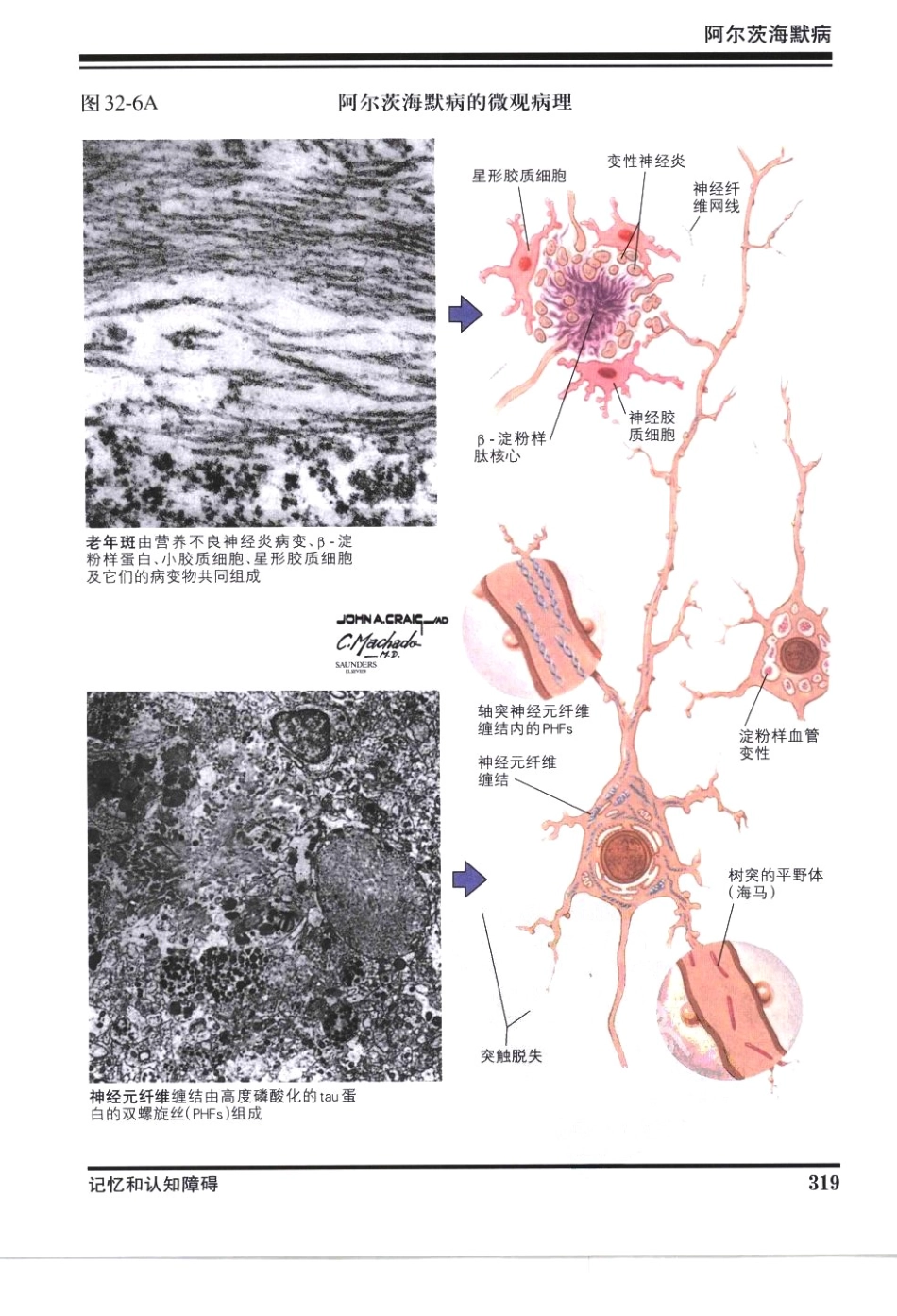 奈特神经系统疾病彩色图谱_樊东升2009译（全彩图）_331-360.pdf_第2页