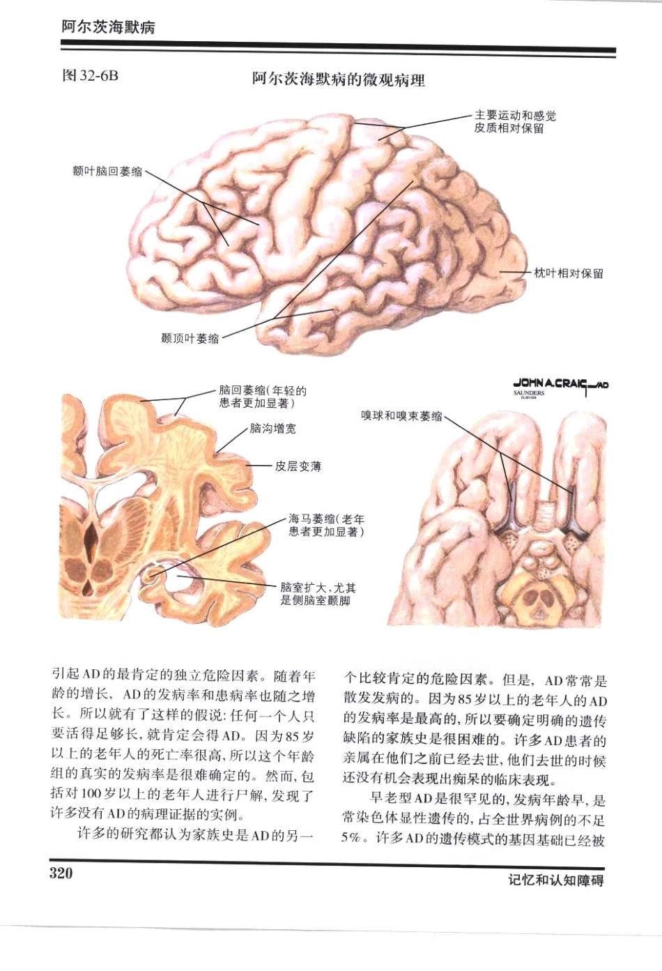 奈特神经系统疾病彩色图谱_樊东升2009译（全彩图）_331-360.pdf_第3页