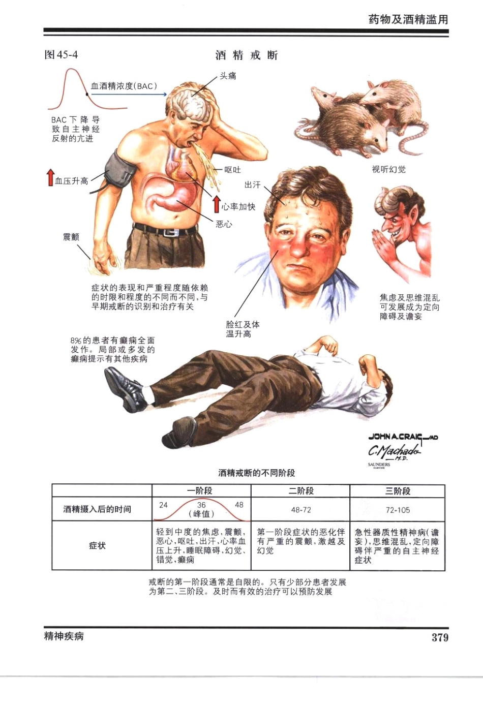 奈特神经系统疾病彩色图谱_樊东升2009译（全彩图）_391-420.pdf_第2页