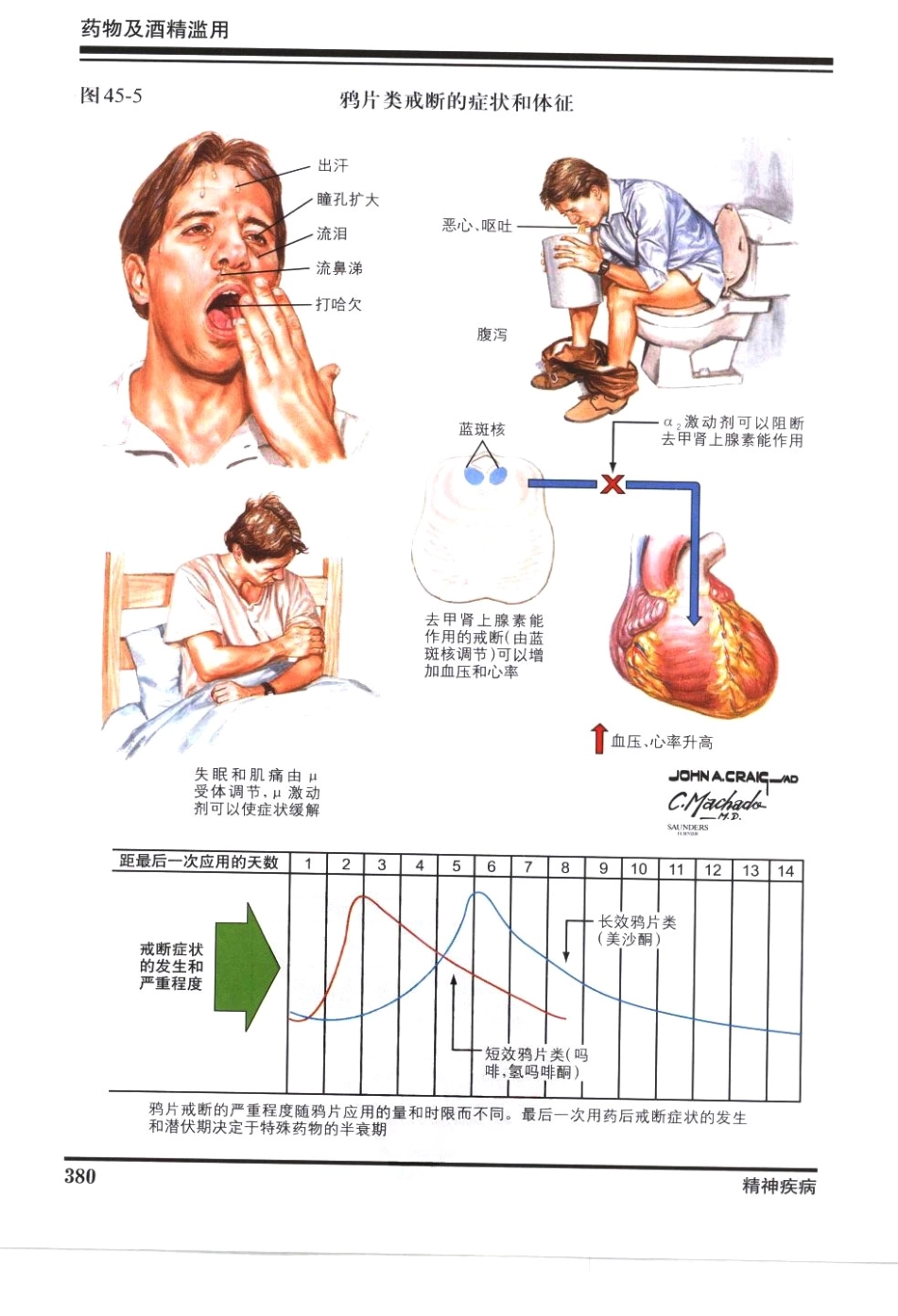 奈特神经系统疾病彩色图谱_樊东升2009译（全彩图）_391-420.pdf_第3页