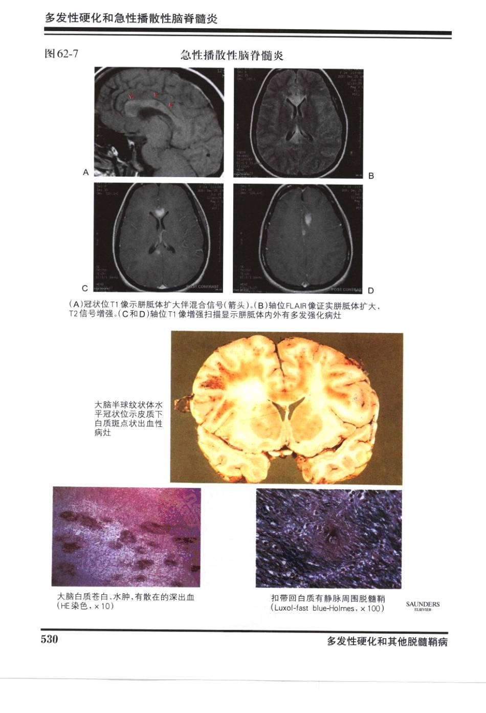 奈特神经系统疾病彩色图谱_樊东升2009译（全彩图）_541-570.pdf_第3页