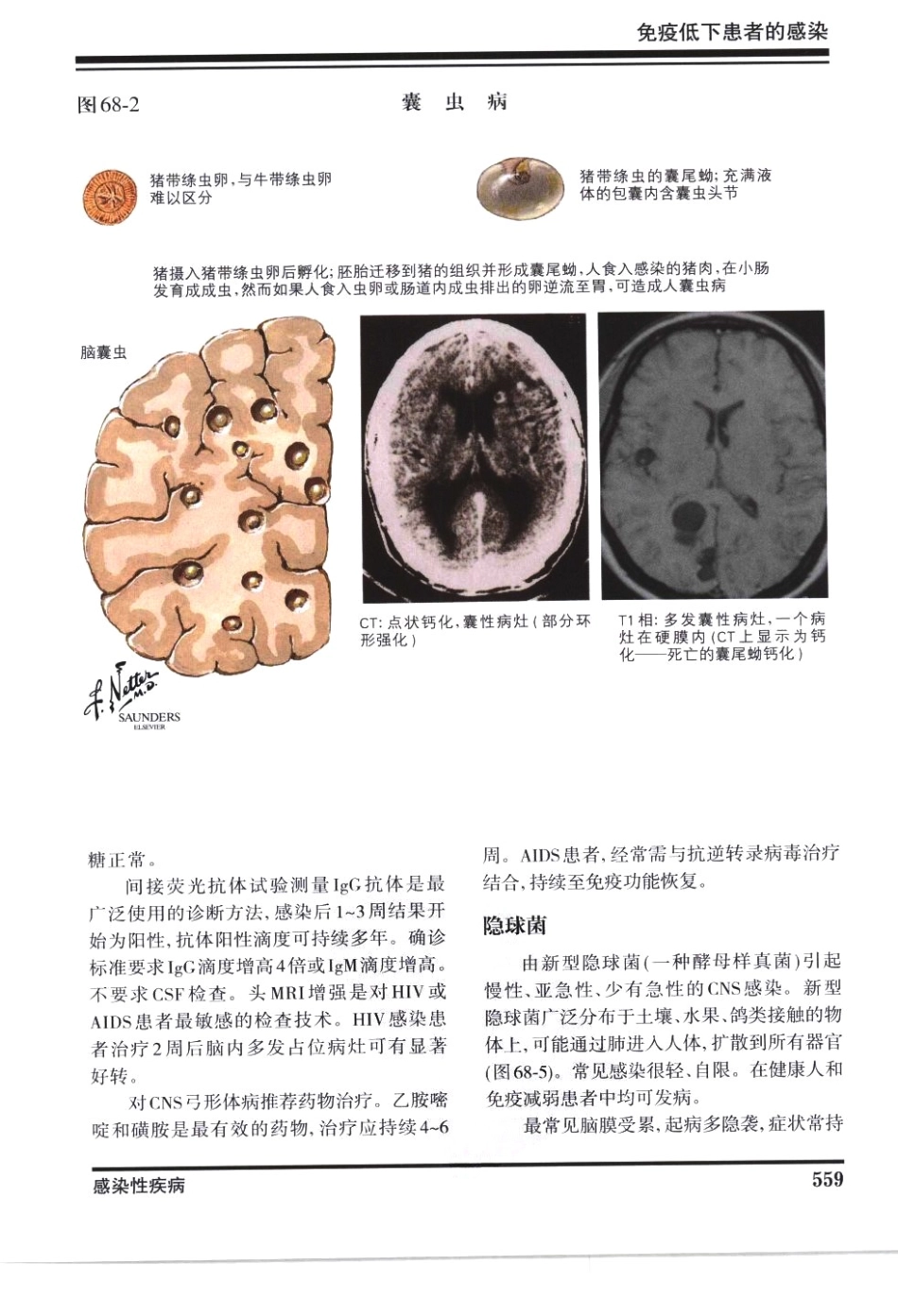 奈特神经系统疾病彩色图谱_樊东升2009译（全彩图）_571-600.pdf_第2页