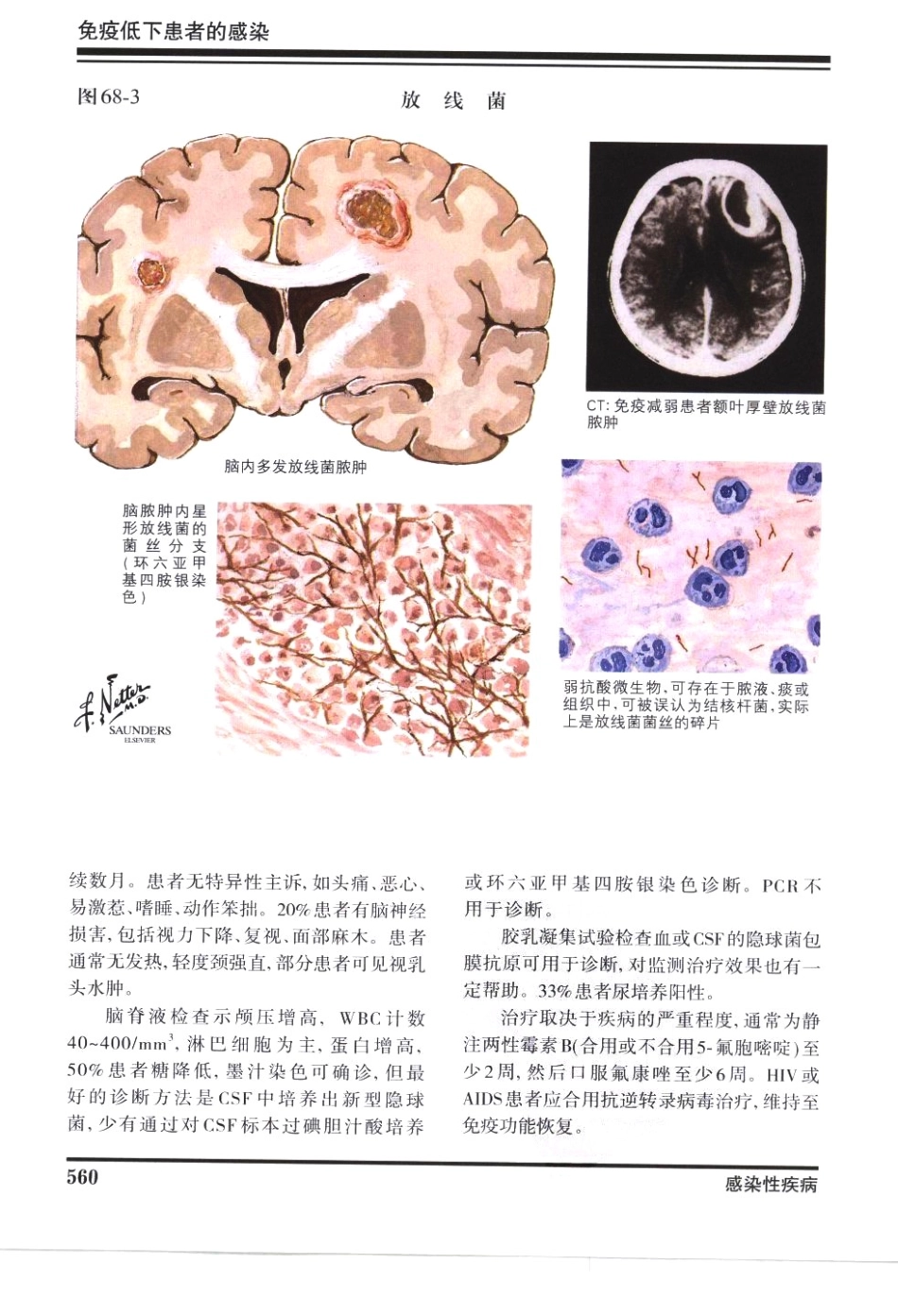 奈特神经系统疾病彩色图谱_樊东升2009译（全彩图）_571-600.pdf_第3页