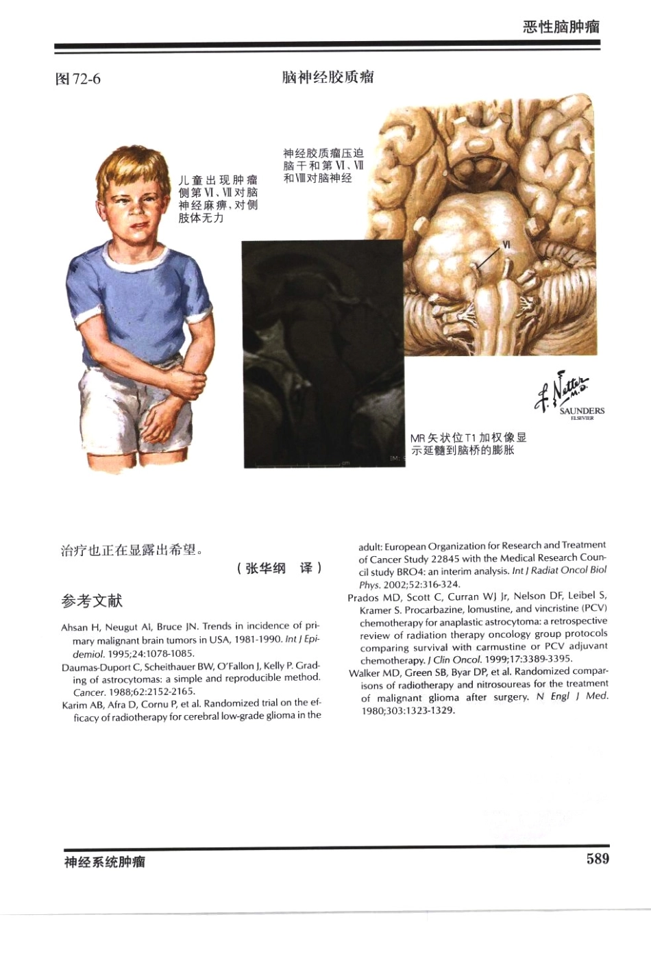 奈特神经系统疾病彩色图谱_樊东升2009译（全彩图）_601-630.pdf_第2页