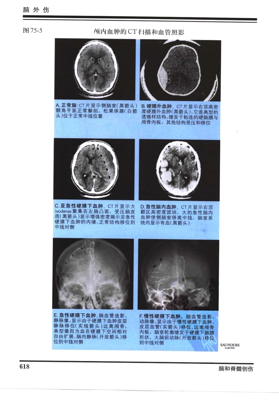 奈特神经系统疾病彩色图谱_樊东升2009译（全彩图）_631-660.pdf_第1页