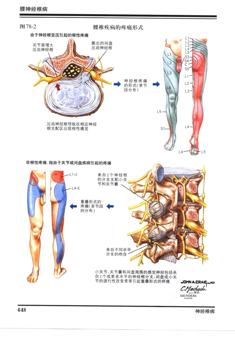 奈特神经系统疾病彩色图谱_樊东升2009译（全彩图）_661-690.pdf_第1页