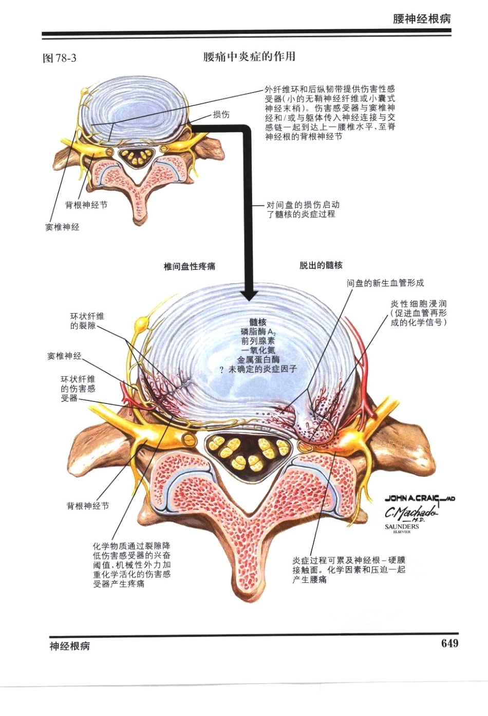 奈特神经系统疾病彩色图谱_樊东升2009译（全彩图）_661-690.pdf_第2页