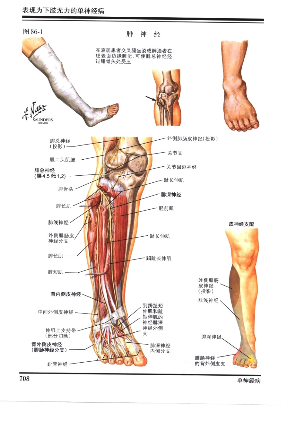 奈特神经系统疾病彩色图谱_樊东升2009译（全彩图）_721-750.pdf_第1页