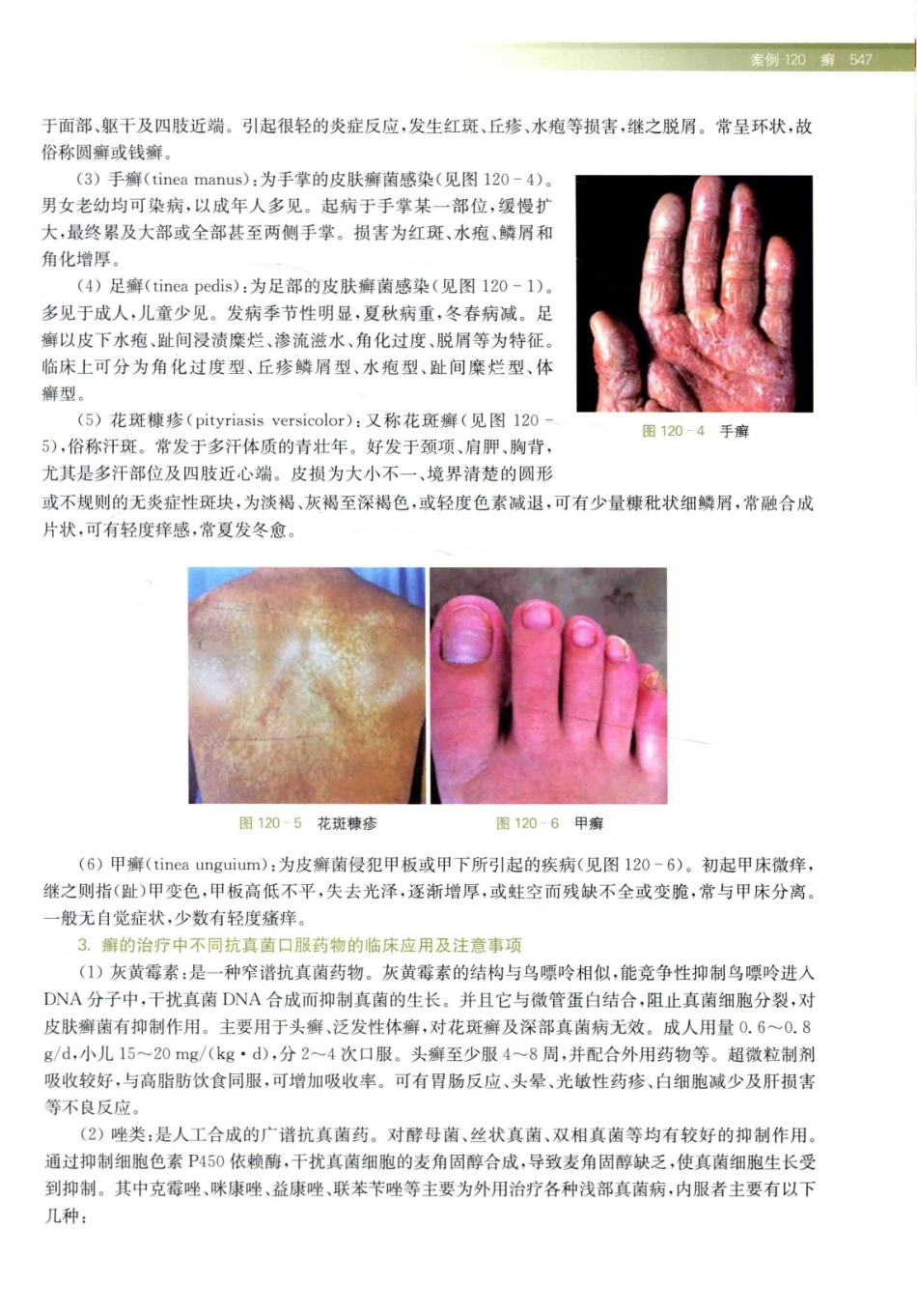 住院医师规范化培训全科医学科示范案例=GENERAL PRACTICE CASE STUDY_13984526_561-580.pdf_第1页